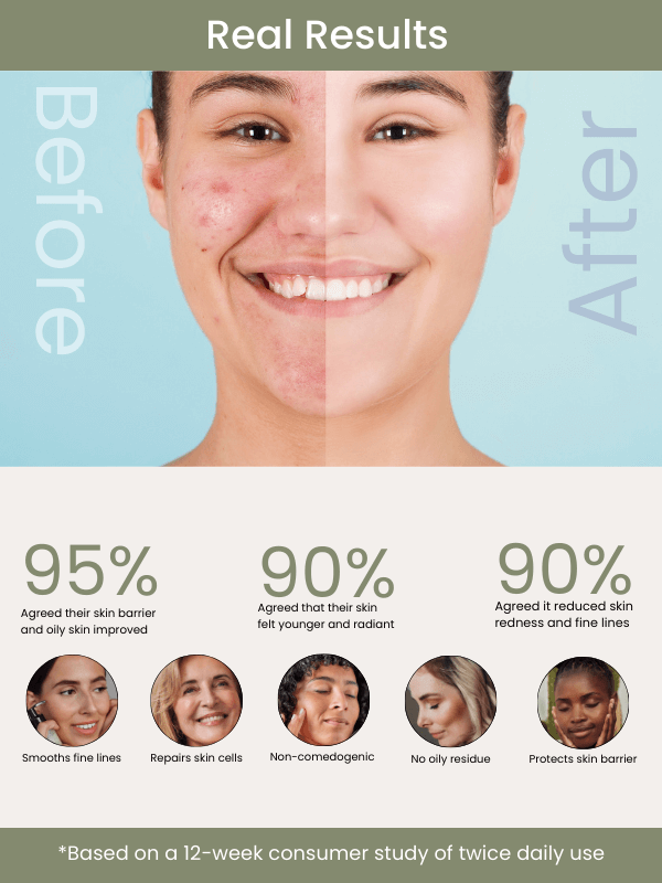 Skin Creamery Aceite Hidratante Facial y Tratamiento Restaurador | 30ML